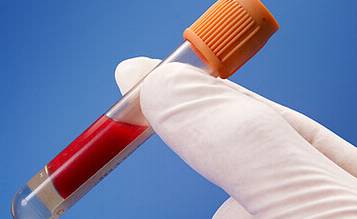 贫血一直补血为什么还是贫血,轻型地中海贫血中度贫血怎样补血