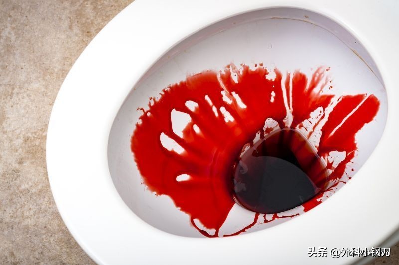 心好方，便便里面全是血，不想去医院，是不是癌啊，我该咋办？