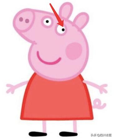 小孩弱视看东西歪头斜着看怎么办,孩子斜视看东西总歪头