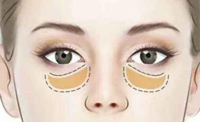 女人有眼袋不要慌，每天睡前坚持4个习惯，眼部肌肤紧致又细嫩