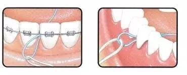 为什么医生不建议牙齿矫正呢,为什么医生不建议矫正牙