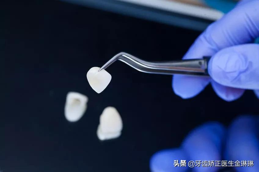 诺尔口腔牙齿矫正怎么样,淄博诺尔漫齿科种植牙价格