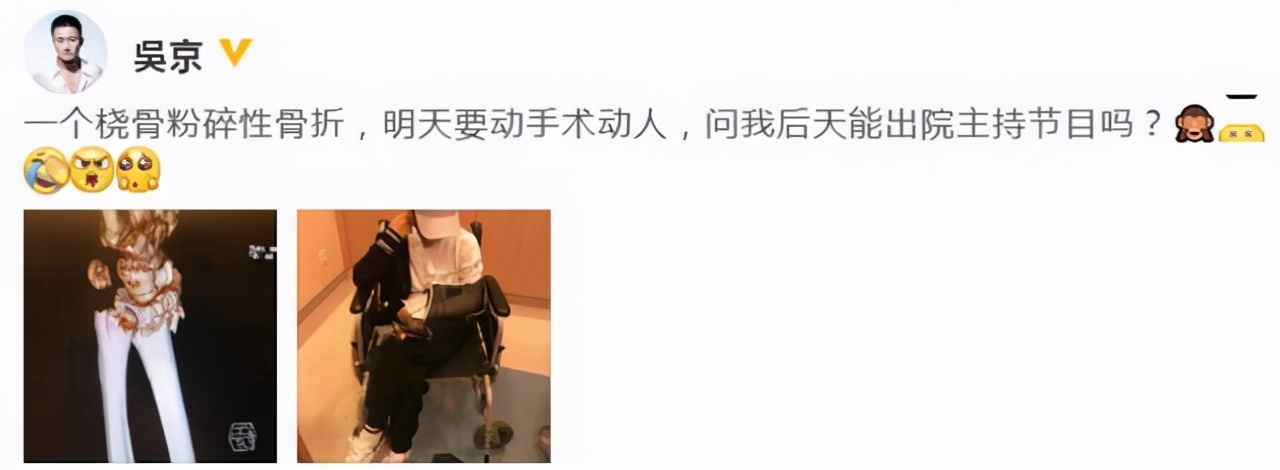 谢楠桡骨粉碎性骨折手术后锻炼,谢楠桡骨骨折怎么康复