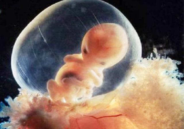 组图*放播**精子和卵子结合全过程，精子：找个媳妇，太难了