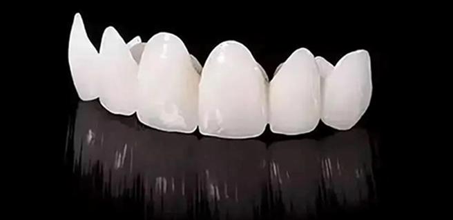氧化锆全瓷牙耐磨吗,致晶氧化锆全瓷牙怎么样