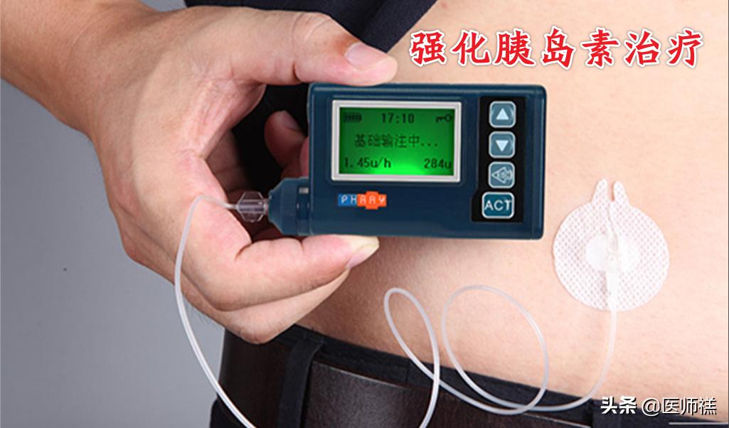 2型糖尿病用药指导注意事项,二型糖尿病用药指南