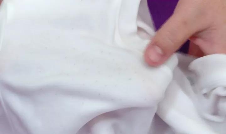 衣服上的小黑点怎么去,衣服出现小黑点怎么办