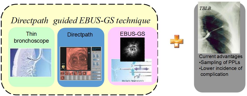 支气管镜高频电刀治疗中央型肺癌,支气管镜在早期肺癌诊断的意义