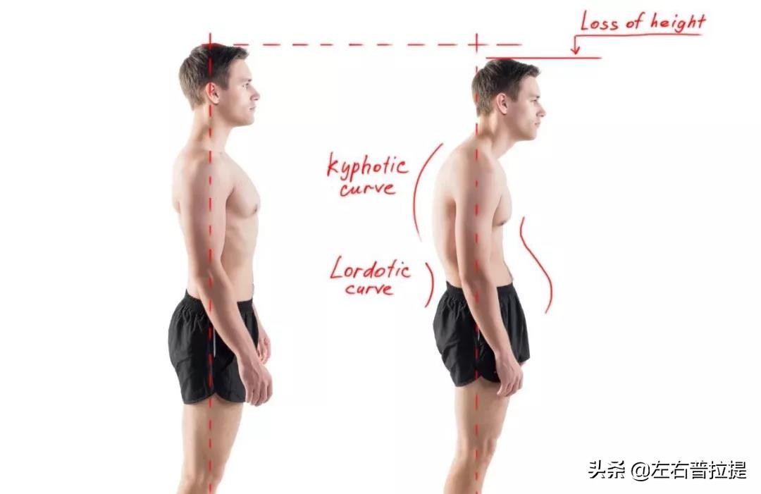 泰勒探颈毁气质?杨幂驼背变猥琐?教你1招轻松变美