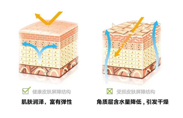 脸要不要去角质,脸有必要去角质