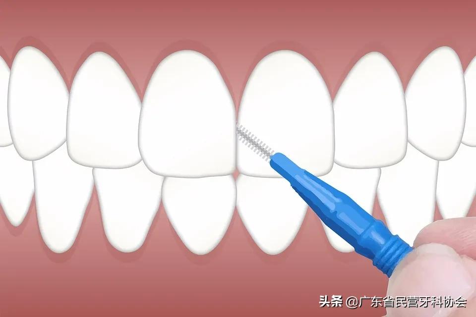 如何正确使用牙线清理牙齿,牙线的正确使用方法丁香医生