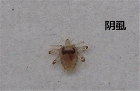 夫妻得了阴虱如何知道谁传染的谁,女性感染阴虱会引发什么病