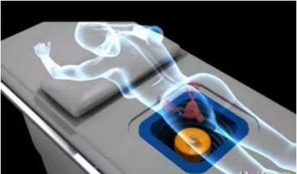 微创治疗子宫腺肌症，副作用大，还容易复发