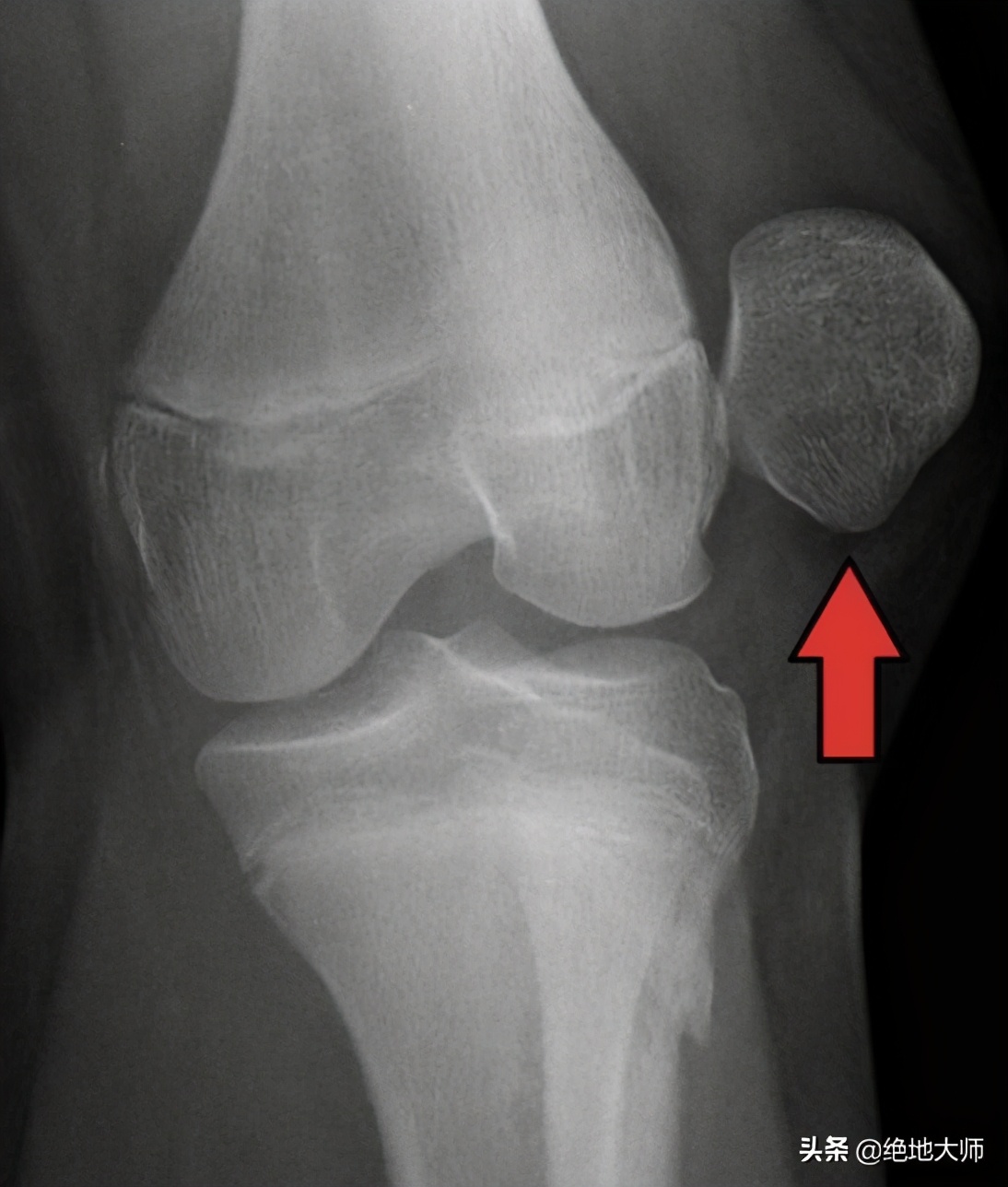疼痛治疗学课程,疼痛康复培训班