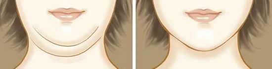 双下巴怎么减最快,双下巴怎么迅速减下来