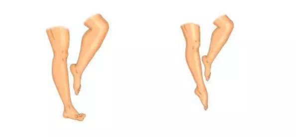 见康|舒淇摔得好惨，处理摔倒谨记“RICE原则”