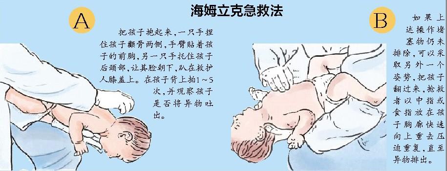 孩子吃饭异物卡喉,如果孩子出现异物卡喉怎么办