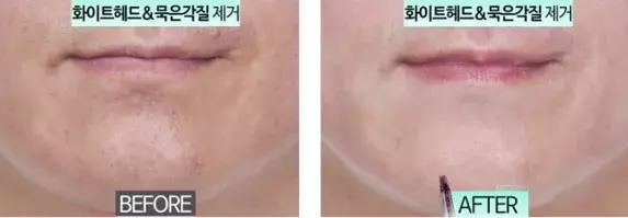 张韶涵推荐去角质视频,张韶涵出绝招