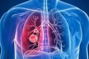 疫情笼罩下怎么过,疫情服装行业怎么办