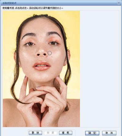 皮肤老化斑点怎么去除,斑点橡皮擦真的能一秒祛斑吗