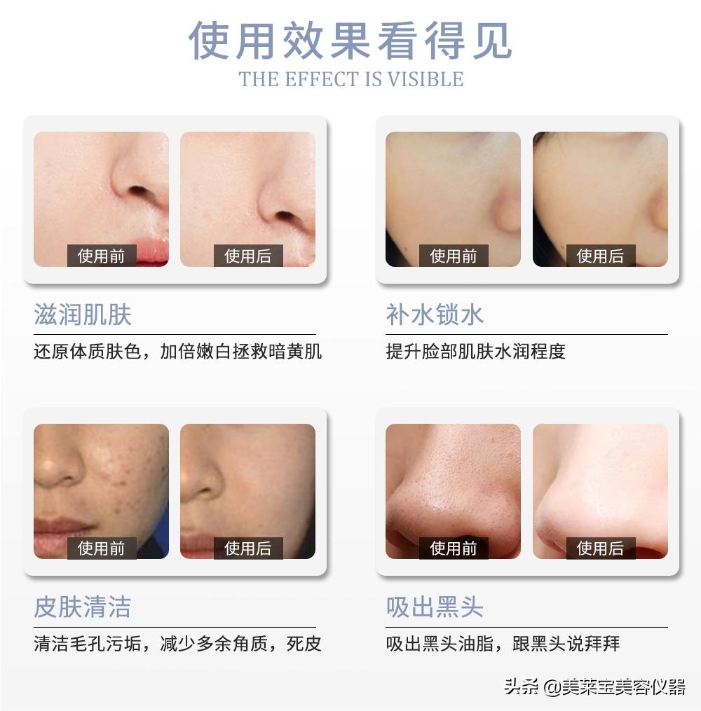 美容院小气泡清洁全过程,美容院的小气泡深层清洁怎么做