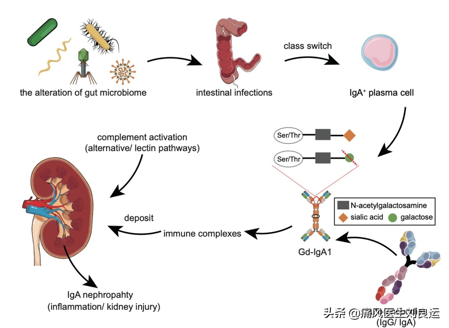 尿频是前列腺炎吗,尿酸高对前列腺有啥影响