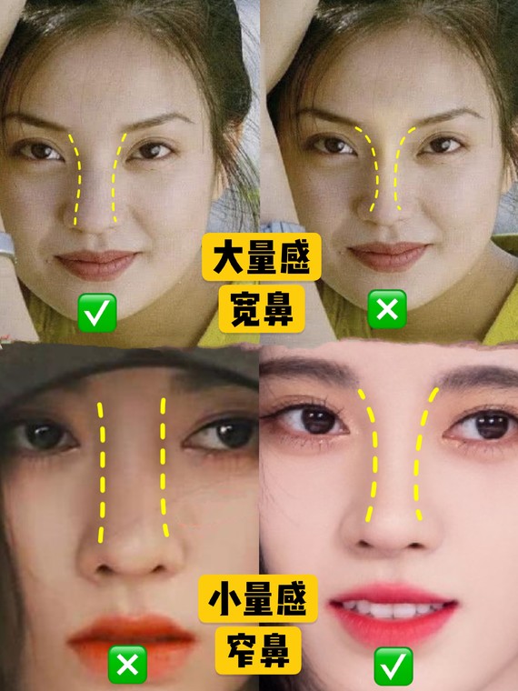 好看的鼻子类型驼峰鼻,好看的鼻型有哪几种