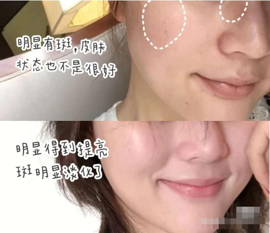 李佳琦推荐淡斑去皱美白,什么样的人最容易长细纹