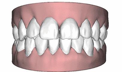 诺尔口腔牙齿矫正怎么样,淄博诺尔漫齿科种植牙价格