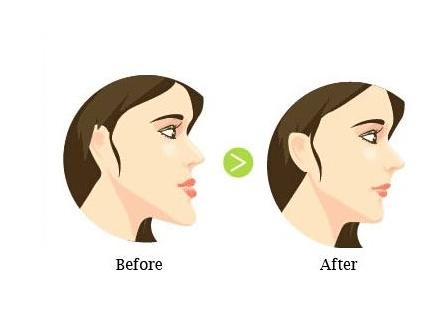 牙齿矫正有什么办法减轻疼痛感,牙齿矫正传统矫正vs隐形矫正