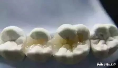 看牙贵早已成为无数人心中的痛点,为什么你会觉得看牙贵