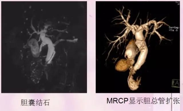 核磁共振能看出来哪些病症,核磁共振可以检查良恶性吗