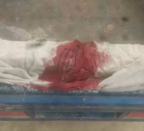 甘肃八岁女孩被打,八岁女孩被打后出血