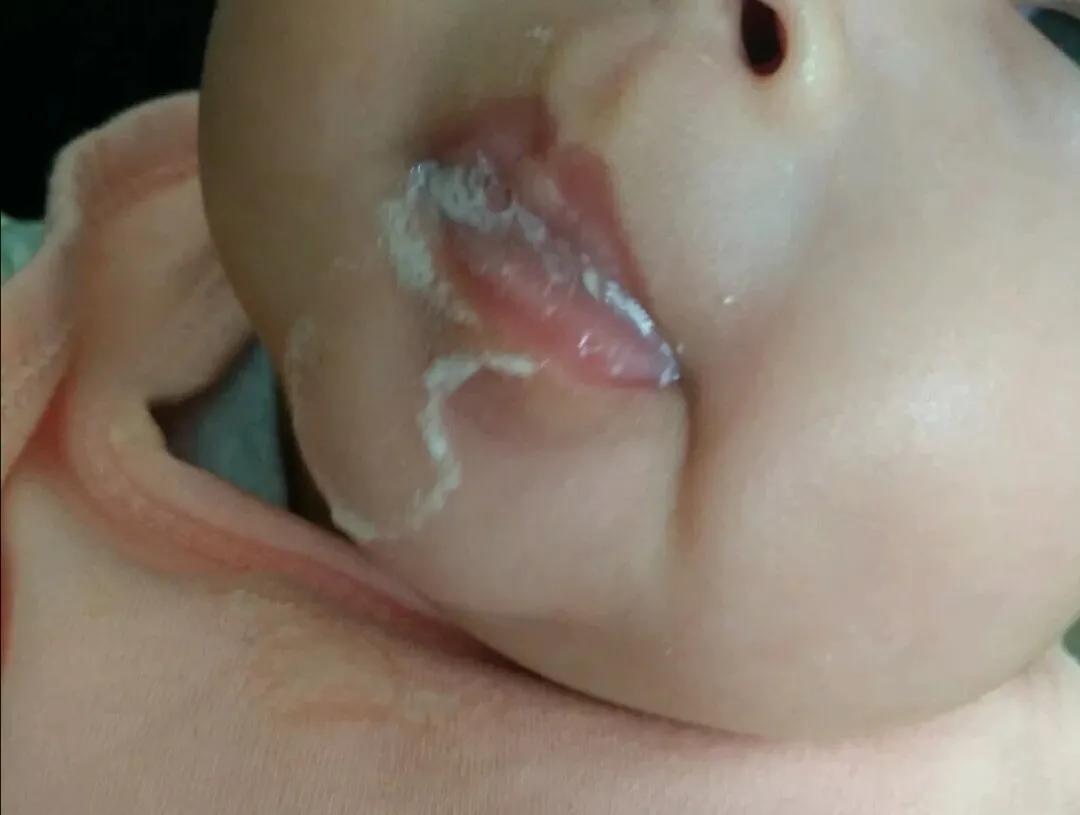 宝宝吐奶频繁影响睡眠,婴儿吐奶跟喉软骨发育不全有关吗