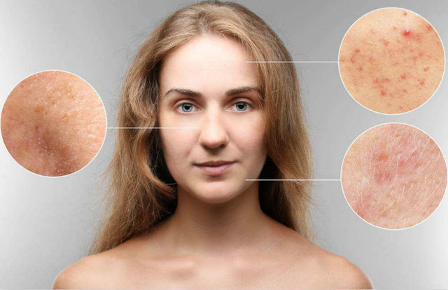 40岁女人怎么祛黄提亮肤色,40岁女人的脸部保养