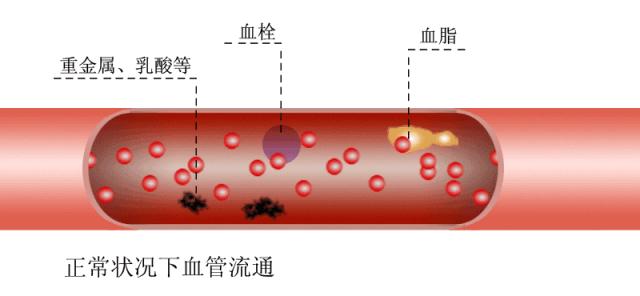 再生医学干细胞治疗脑出血,干细胞治疗脑梗后遗症的效果视频