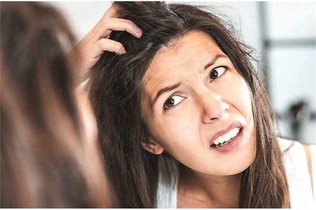 头皮上抠出白泥是螨虫还是头皮屑,头皮有螨虫怎么除螨