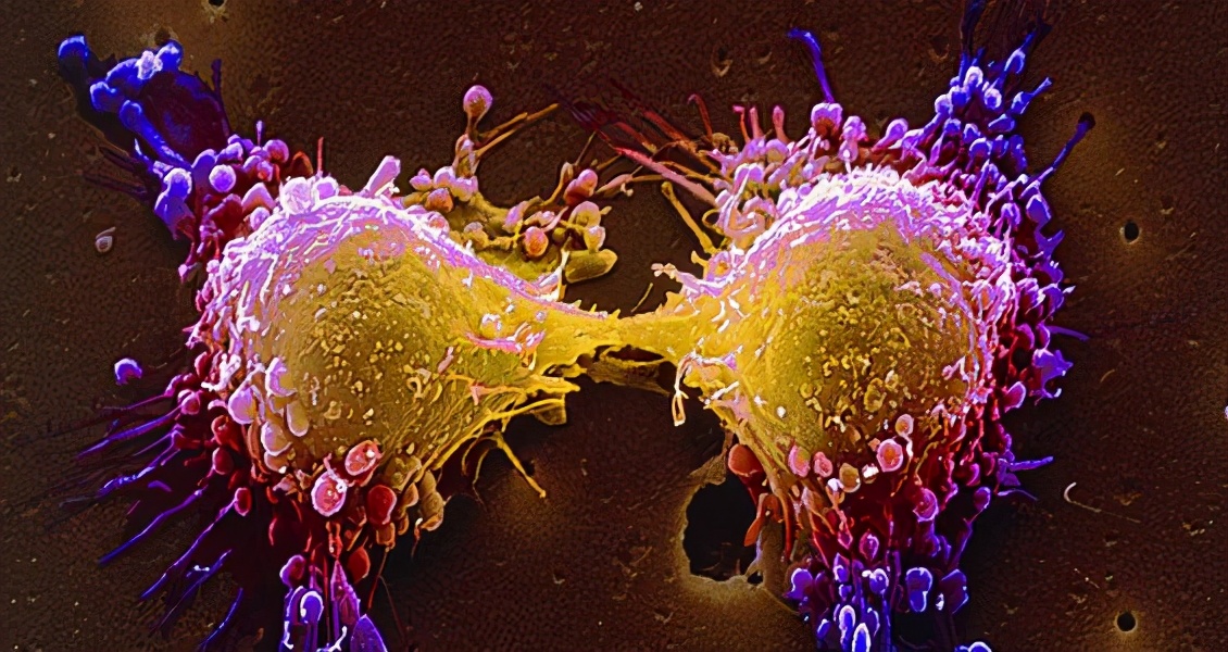 视网膜母细胞瘤恶性肿瘤,视网膜母细胞瘤是什么遗传病