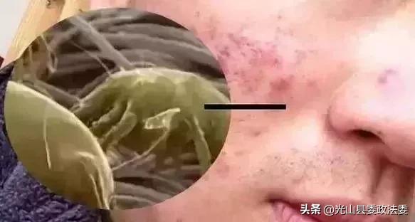 蚕丝被盖了几年烂了,蚕丝被被曝光了