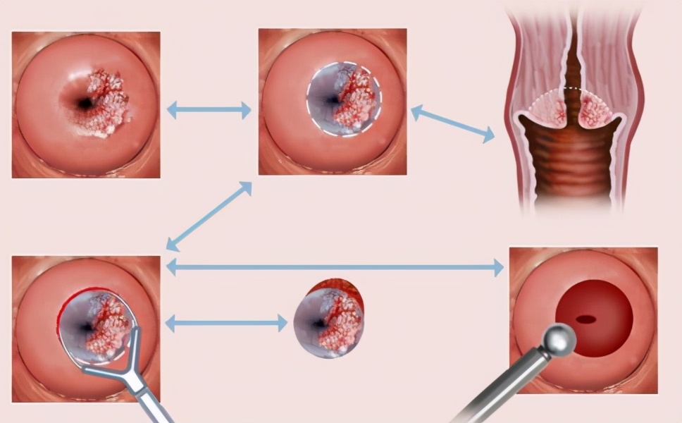 影响女性健康的四大杀手,危害女性健康的第一杀手