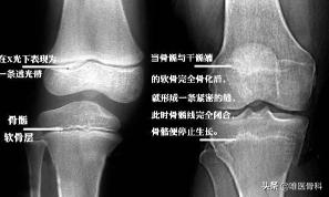 跳高体育之星,跳高的理想身高