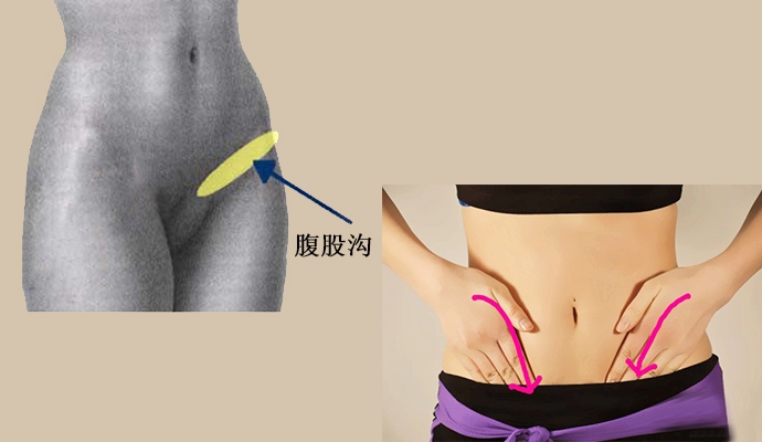 大腿根部恶性肿瘤的前兆,大腿根部内侧长个包是癌吗