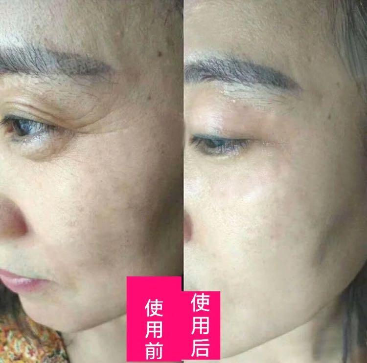 雅萌美容仪与宙斯美容仪哪个好,雅萌和宙斯美容仪对比