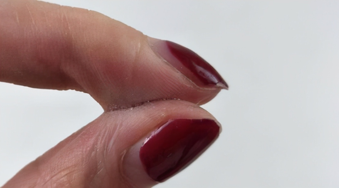 用502胶粘人事故,两小伙被502胶水粘住了