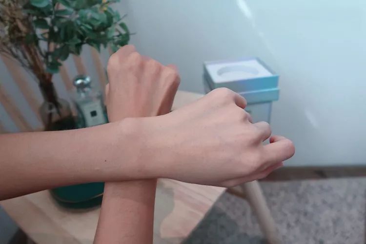 有一种丑叫内分泌失调,有一种丑叫做肤色不均的图片