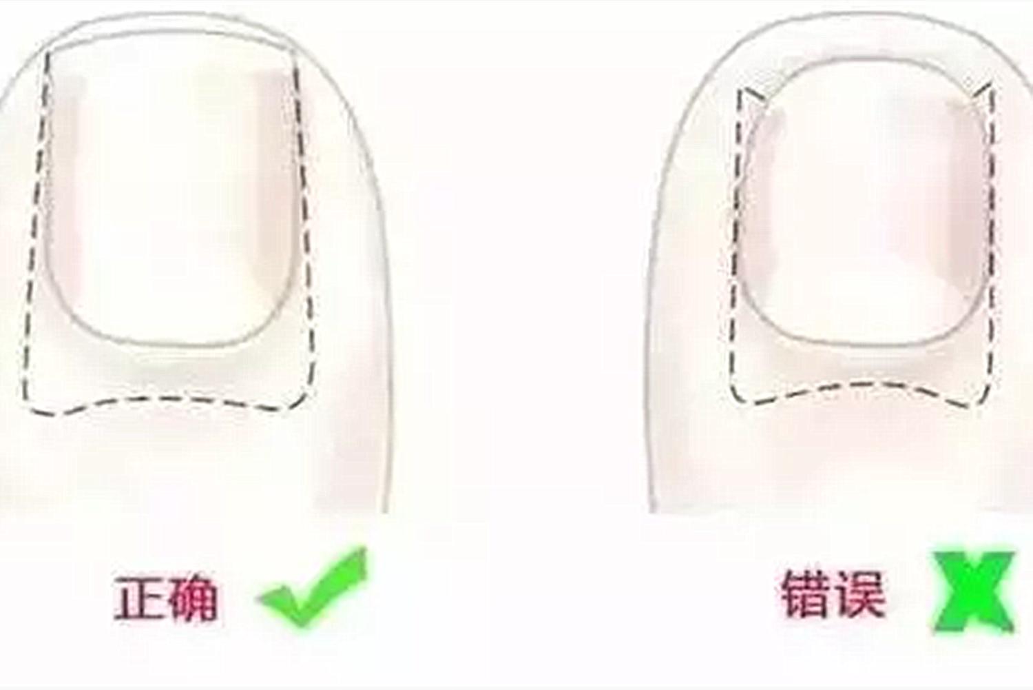 有什么好办法给婴儿剪指甲,给宝宝剪指甲如何防剪到肉