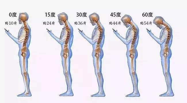说一个可怕的消息:总低头看手机,颅底可能生骨刺……
