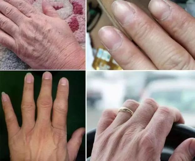 妮娜泰勒是谁,妮娜泰勒的手