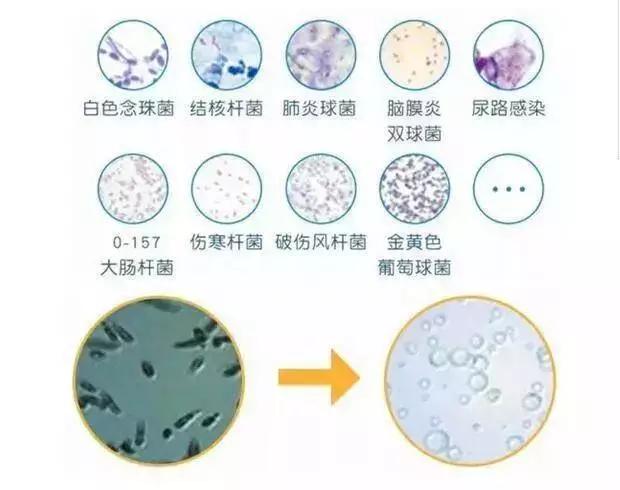 洗衣神器免洗去顽固污渍,洗衣神器去霉斑汗渍