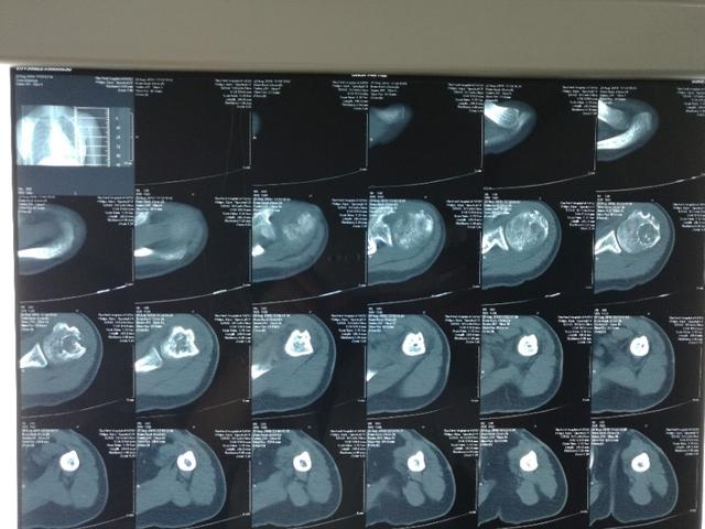 风湿科常见病,罕见的风湿免疫系统疾病